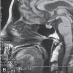 Voz de Niña Juguetona