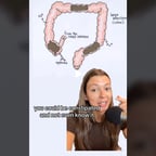 are you constipated lets compare transit times