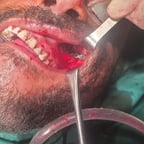 صوت مذيع يمني 