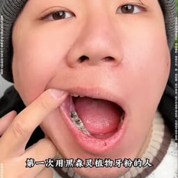 第一次用黑森灵植物牙粉的人