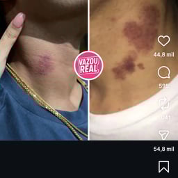 Narrador Português Profissional