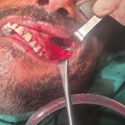 صوت مذيع يمني 